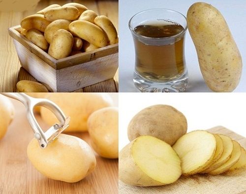 1. Cách trị thâm nách nhanh nhất với nguyên liệu từ khoai tây, bạn đã thử?