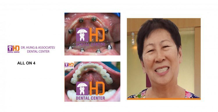 HD Dental Center - Trung Tâm Nha Khoa Dr Hùng &Cộng Sự