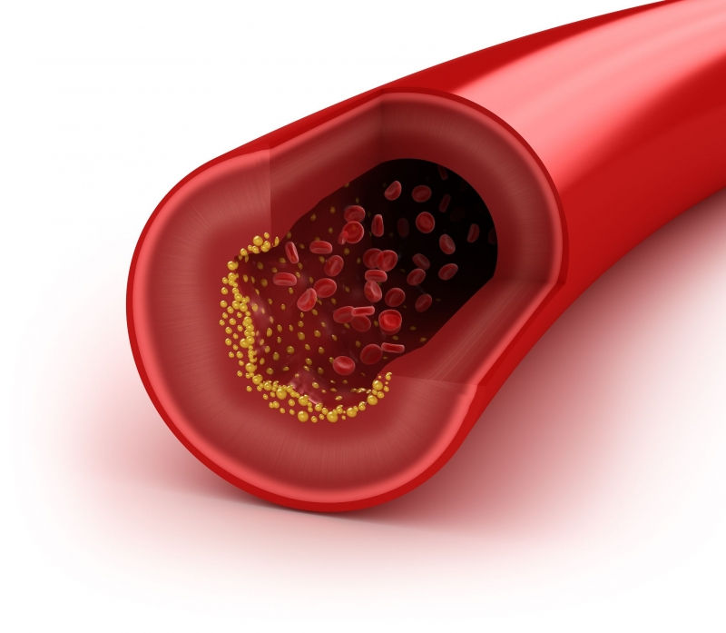 Hạ cholesterol trong máu