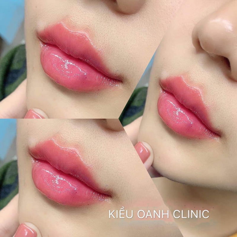 Kiều Oanh Beauty Spa & Clinic
