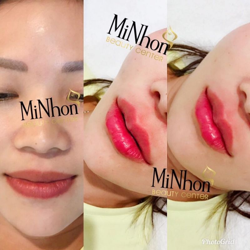 Minhon Beauty Center