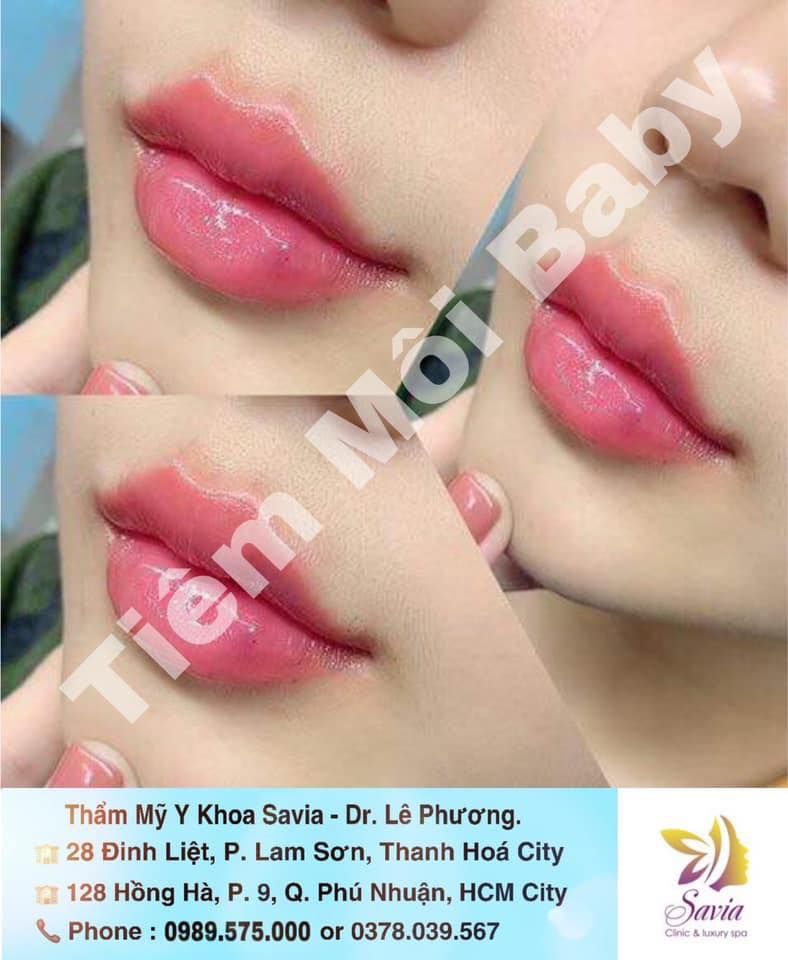 Thẩm Mỹ Y Khoa Savia - Dr. Lê Phương