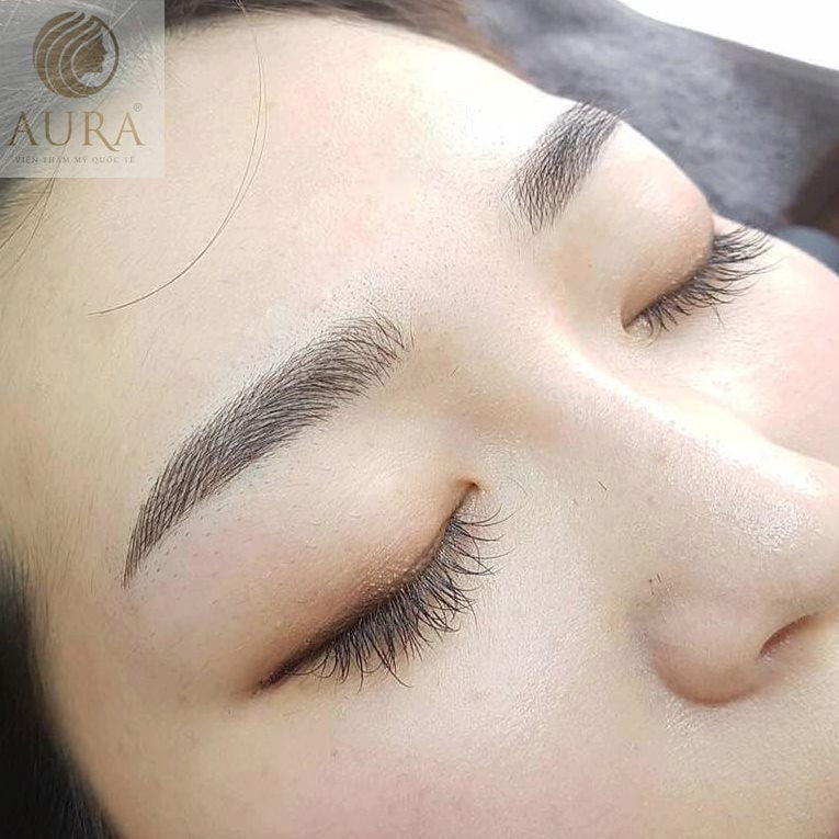 Thẩm Mỹ Quốc Tế Aura - Cần Thơ