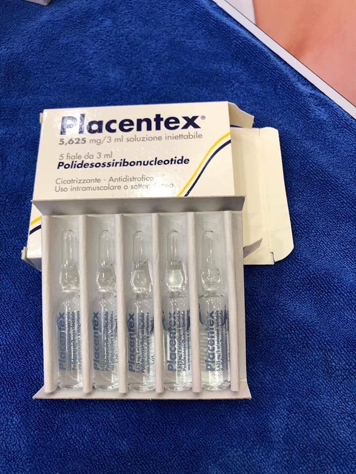 Tiêm cấy tinh chất DNA cá hồi Placentex