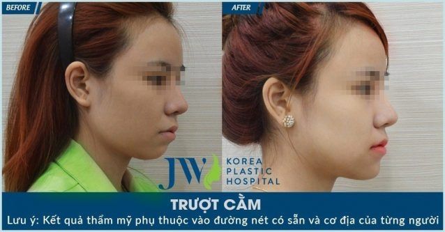 Bệnh Viện Thẩm Mỹ JW Hàn Quốc