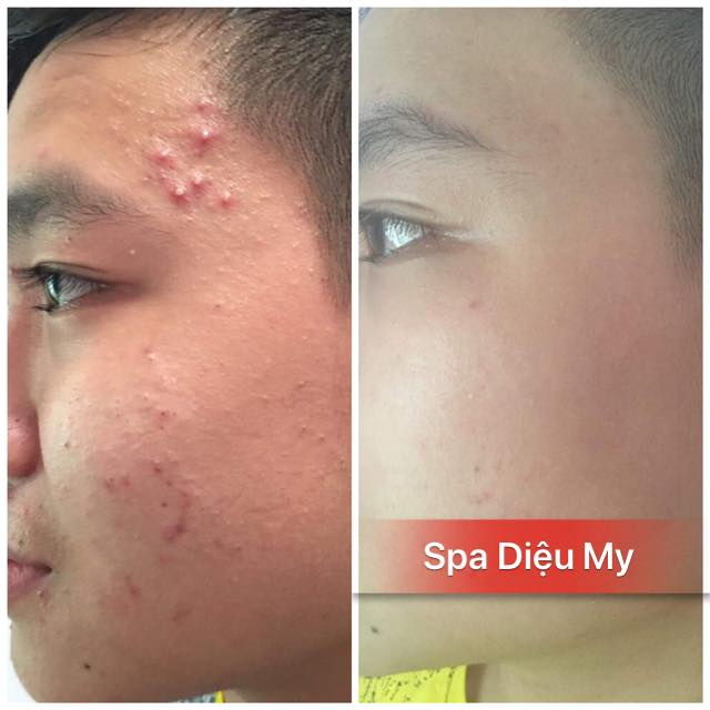 Diệu My Spa