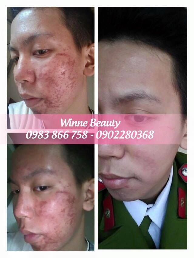 Giang Winnie Beauty & Spa