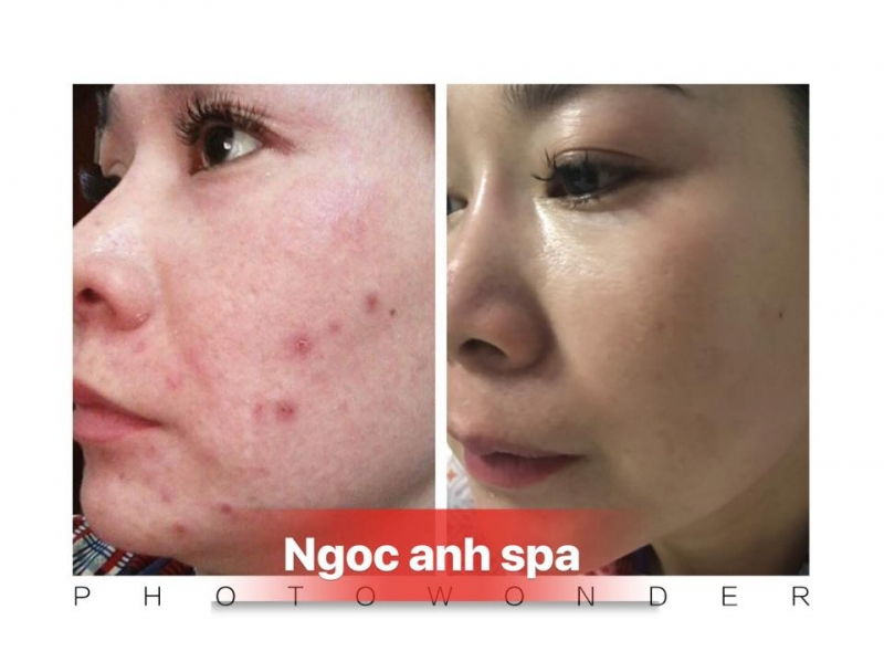 Ngọc anh spa Ngọc anh spa