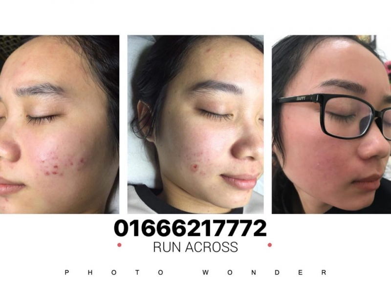 Ngọc anh spa Ngọc anh spa