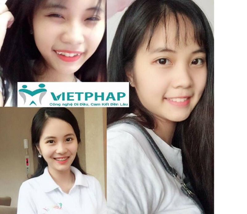 Nha Khoa Việt Pháp