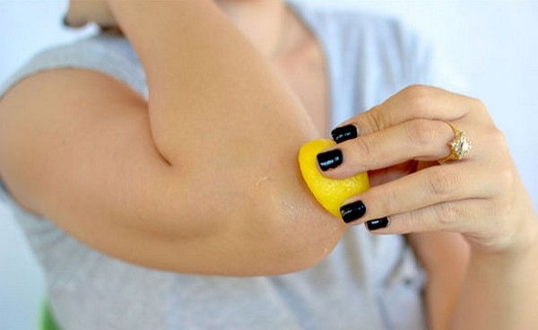 Những nốt vàng xung quanh mắt và khuỷu tay Những nốt vàng xung quanh mắt và khuỷu tay