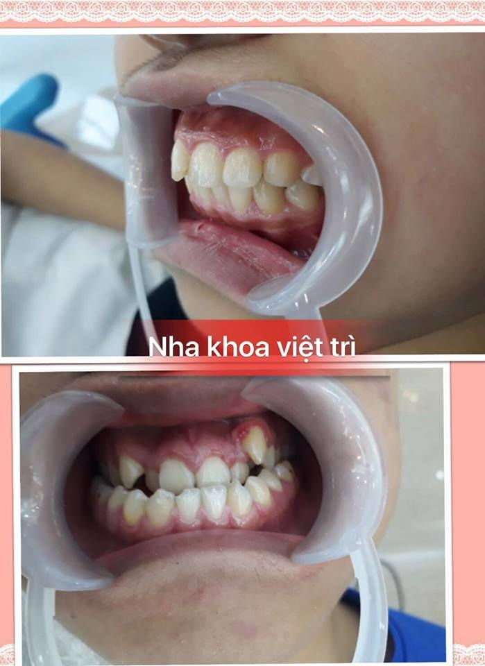 Phòng khám Nha Khoa Việt Trì - B/s Hưng