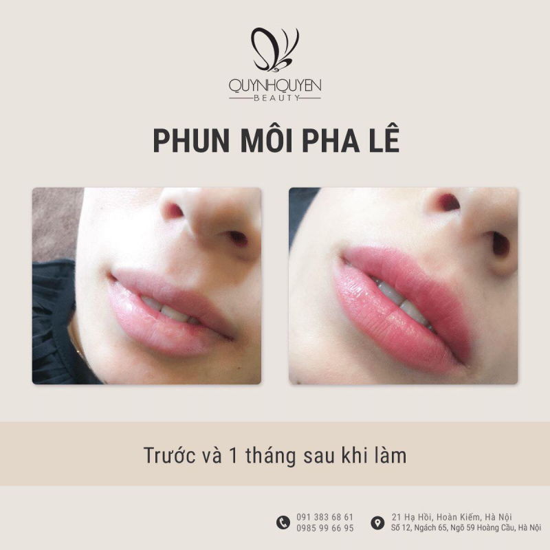 QuynhQuyen Beauty Center