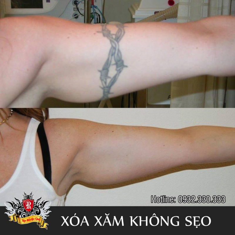 Rio Tattoo Studio (Thẩm mỹ Rio Beauty Spa)