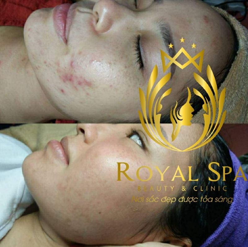 Royal Spa - Beauty & Clinic
