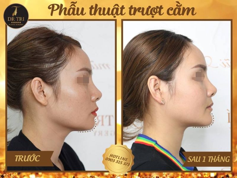 Tiến Sĩ Bác Sĩ Đỗ Thành Trí - Phẫu thuật Thẩm mỹ