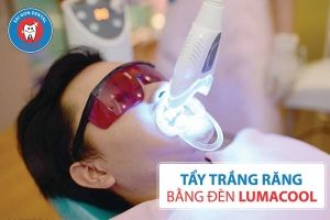 Top 6 Phòng khám nha khoa uy tín nhất Bình Dương - Top Chuẩn