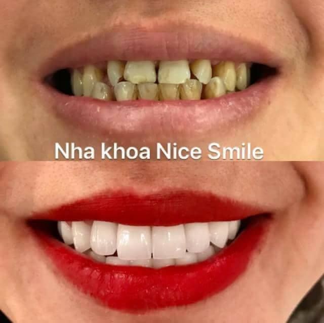 Trang Dentist - Nha Khoa Thẩm Mỹ Nice Smile