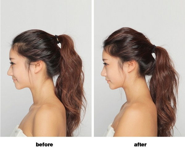 Tóc mỏng Tóc mỏng