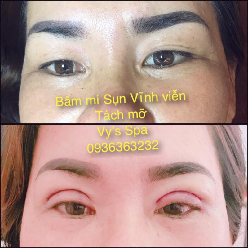 Vy’s Spa Beauty Clinic