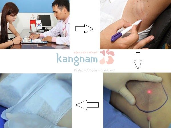 Bệnh Viện Thẩm Mỹ Kangnam