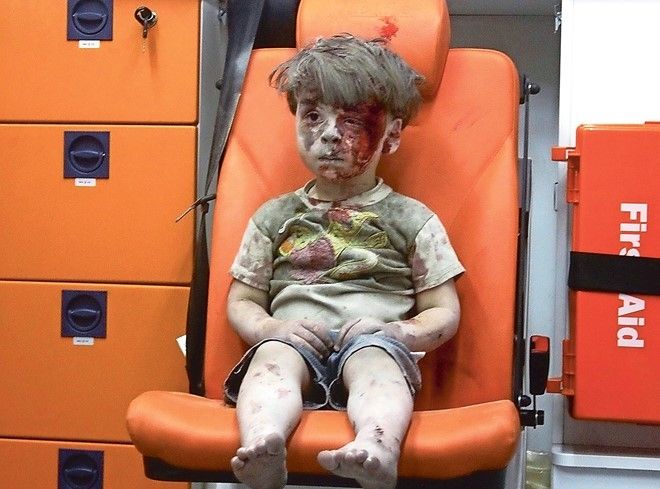 Bức ảnh bé trai 5 tuổi người Syria