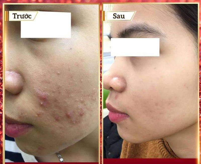 Doctor Spa bác sĩ Kiệm