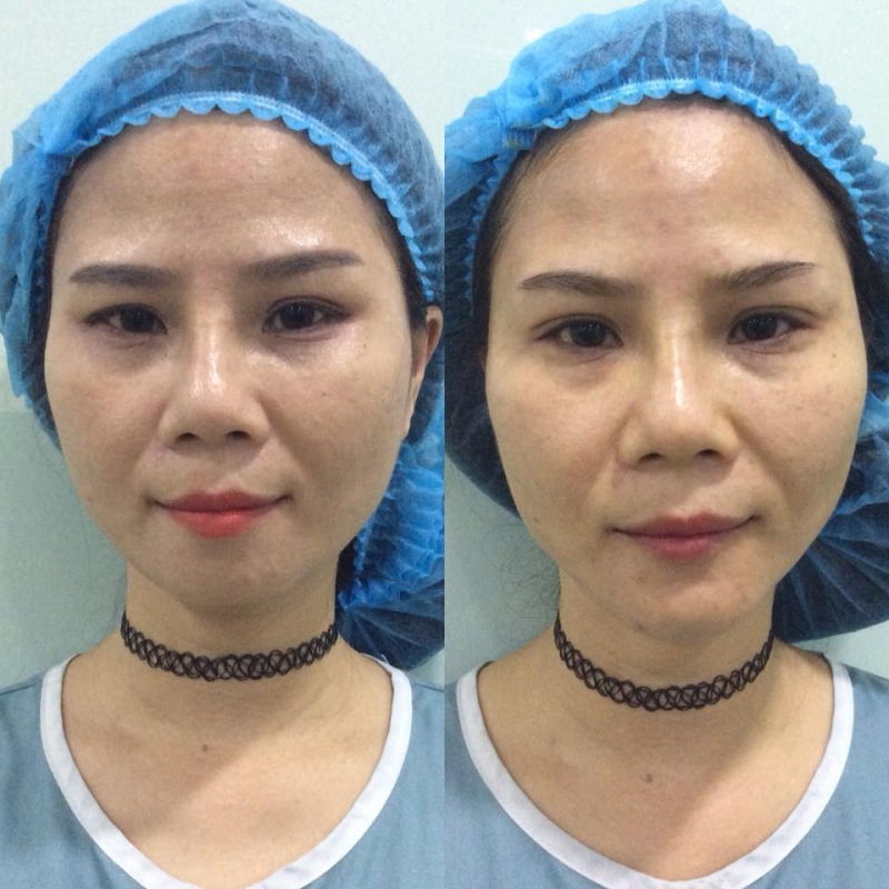 Dr Phi Long - Hera Clinic & Spa