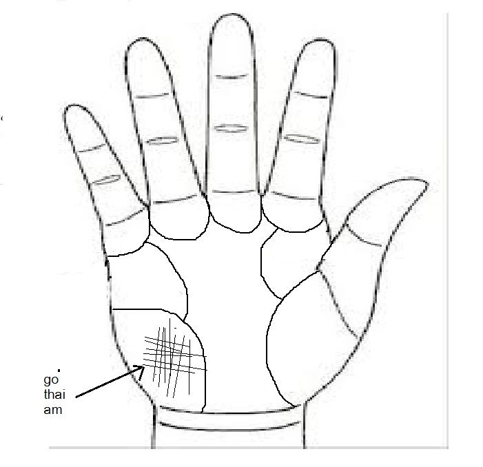 Gò thái âm bị rạch Gò thái âm bị rạch