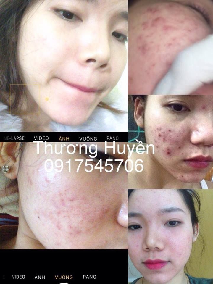 Mỹ phẩm Diệp Phục Linh