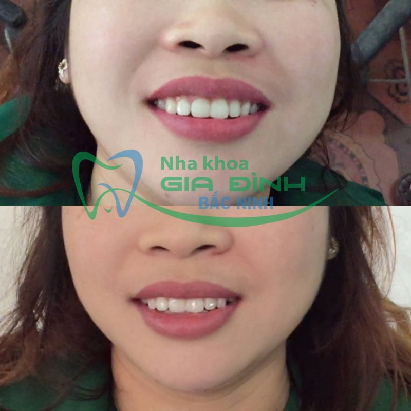 Nha Khoa Gia Đình Bắc Ninh Nha Khoa Gia Đình Bắc Ninh