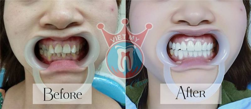 Nha Khoa Việt Mỹ Nha Khoa Việt Mỹ