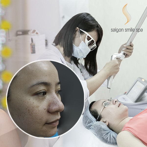 Saigon Smile Spa