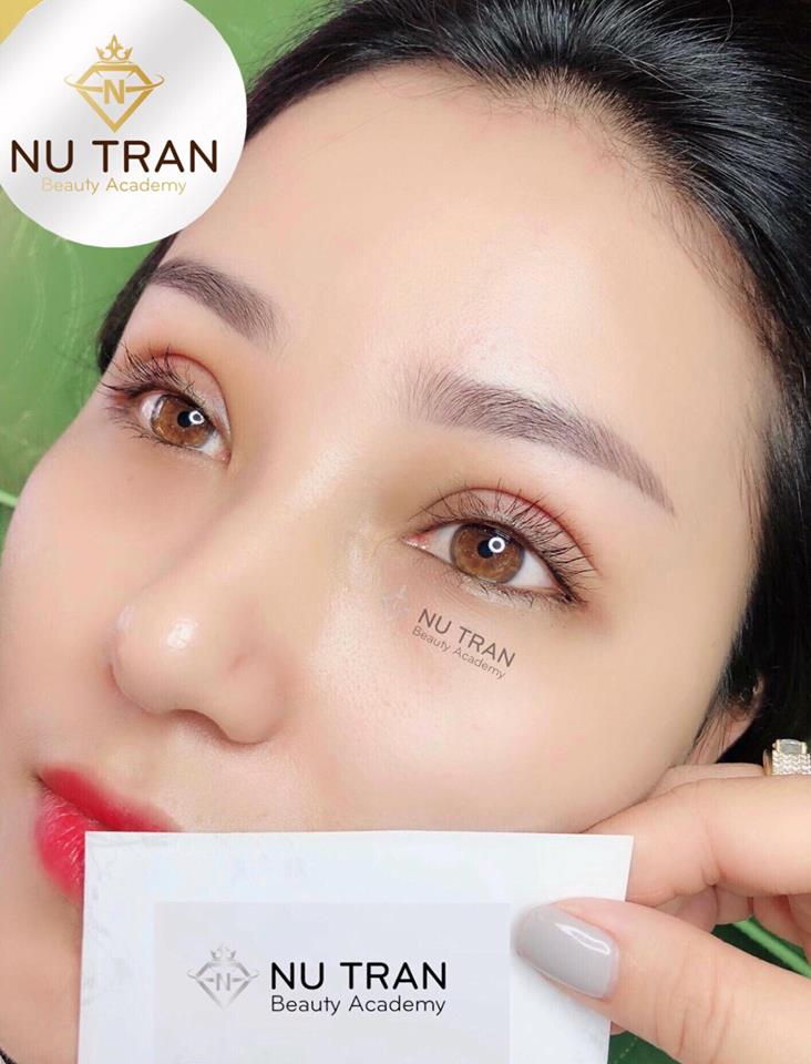 Thẩm mỹ Nụ Trần