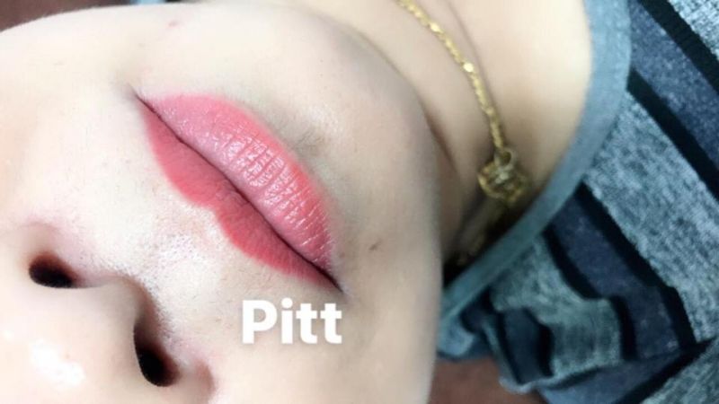 Thẫm mỹ Pitt beauty