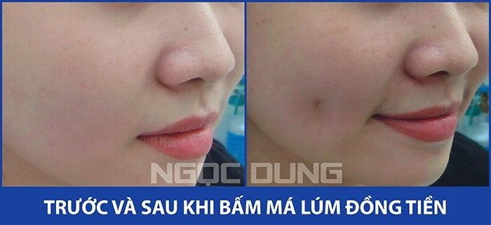 Thẩm mỹ viện Ngọc Dung