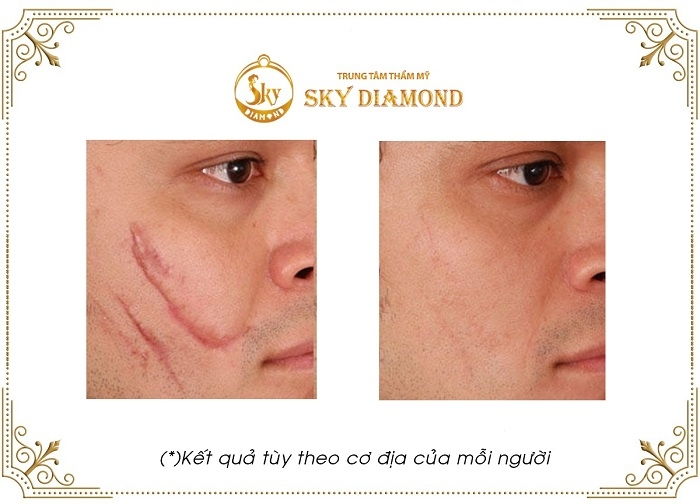 Thẩm mỹ viện Sky Diamond