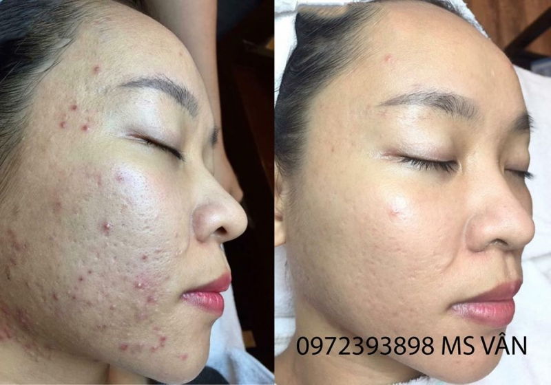 Vân Hải Spa & Beauty