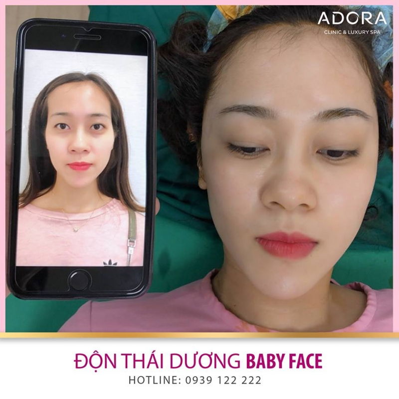 Viện Thẩm Mỹ ADORA