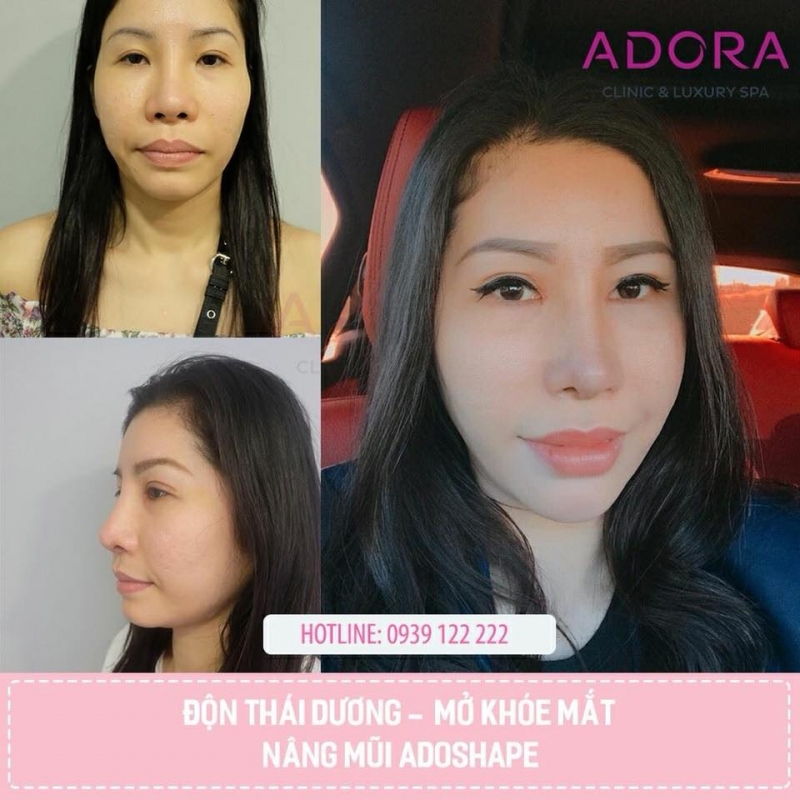 Viện Thẩm Mỹ ADORA