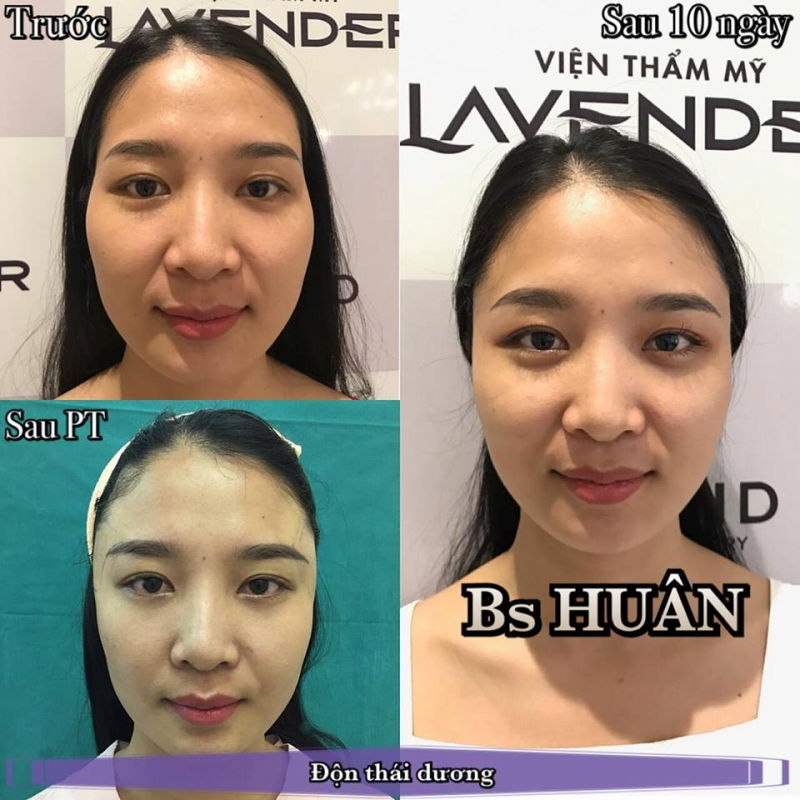 Viện Thẩm Mỹ Lavender