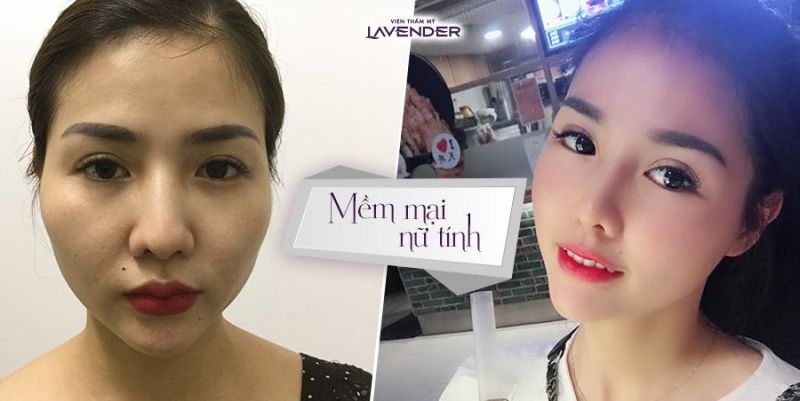 Viện Thẩm Mỹ Lavender