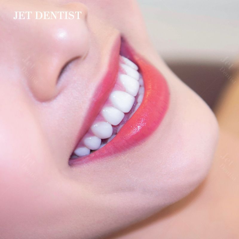 Nha Khoa Thẩm Mỹ Quốc Tế - Jet Dentist