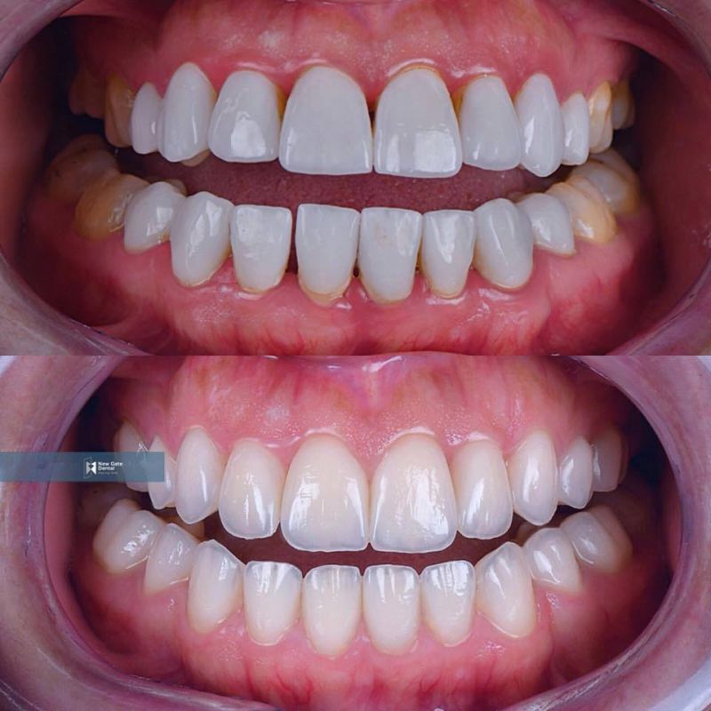 Nha Khoa Việt Mỹ Nha Khoa Việt Mỹ