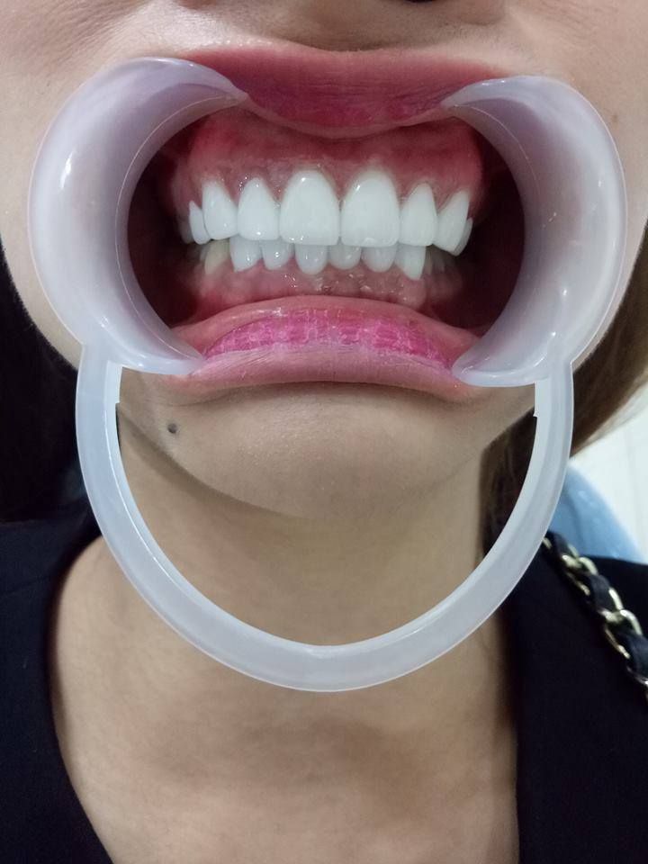 Nha Khoa Việt Mỹ Nha Khoa Việt Mỹ