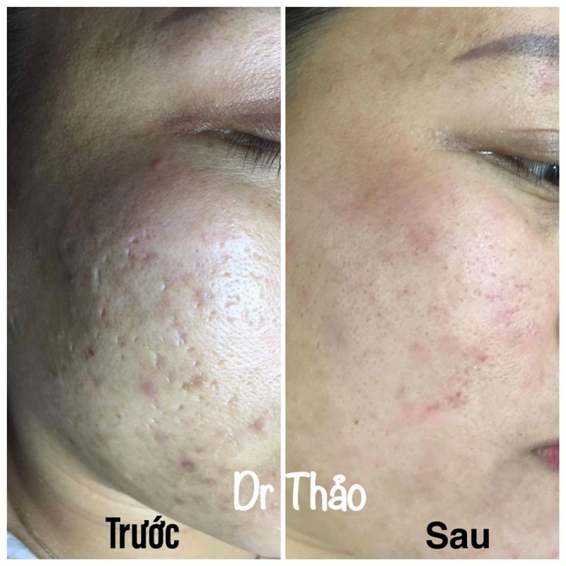 GRACE Beauty Spa & Clinic Huế