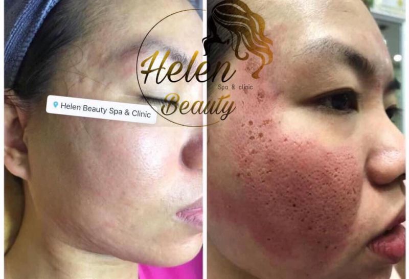 Helen Beauty Spa & Clinic