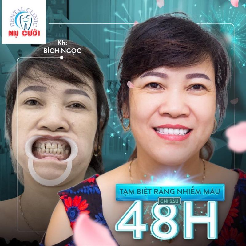 Nha khoa Nụ Cười Cà Mau