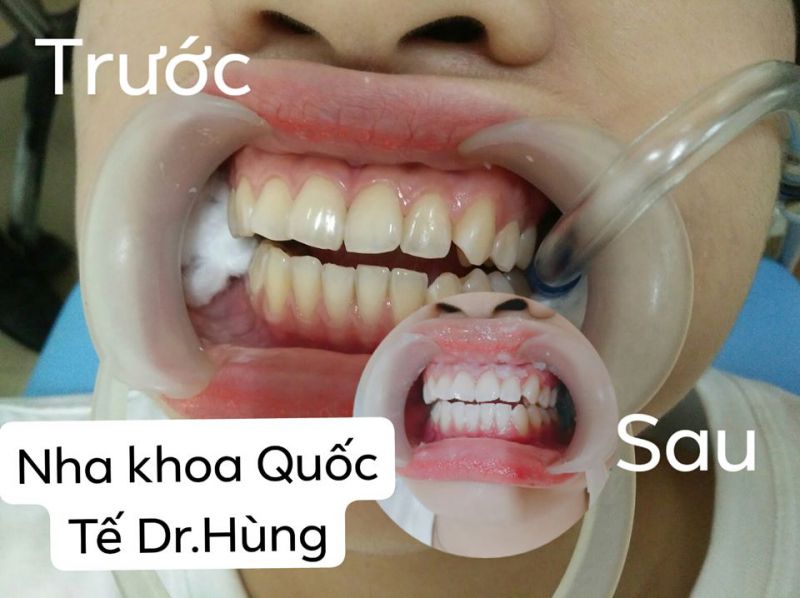 Nha khoa Quốc tế Cà Mau