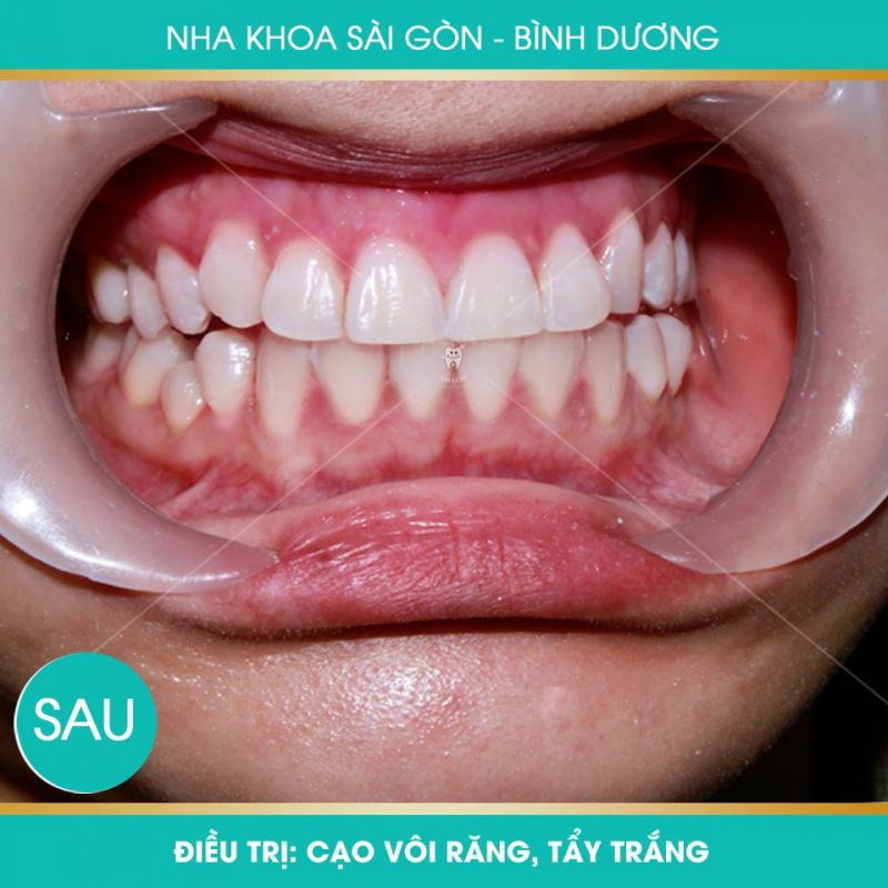 Nha khoa Sài Gòn Bình Dương Nha khoa Sài Gòn Bình Dương